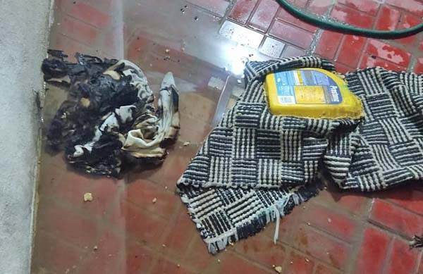 Grave quemado por accidente doméstico