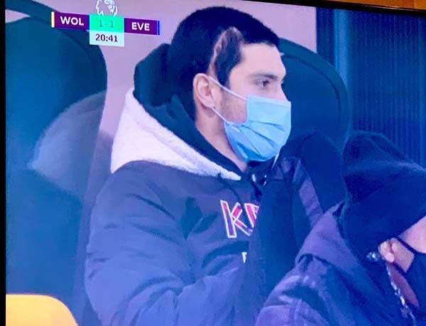 Raúl Jiménez estuvo en su primer partido de Wolves tras fractura con brutal cicatriz