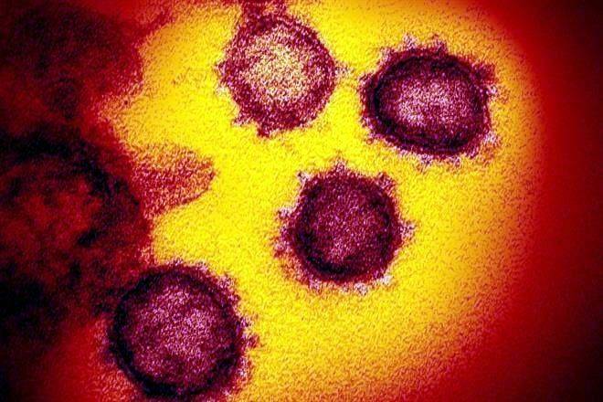 Detectan mutación ‘preocupante’ de virus en variante de RU