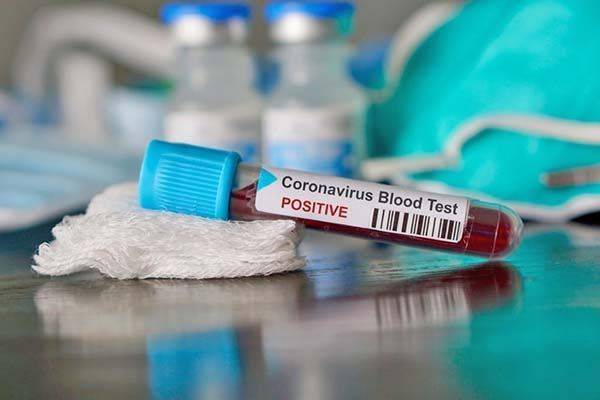 Da pandemia día libre a RC