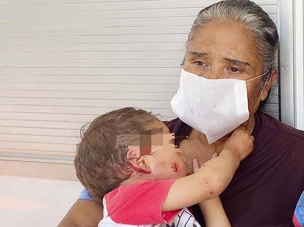 Violento ataque de pitbull a niño