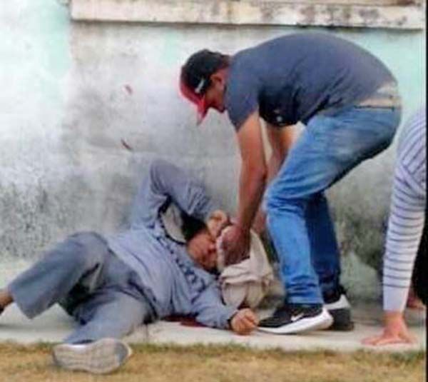 Lucha por vivir; tras salvaje macheteada