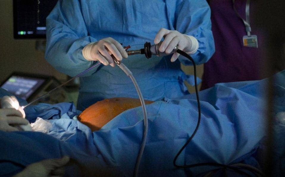 Realizan con éxito cirugía de láser fetal en el Instituto Nacional de Perinatología
