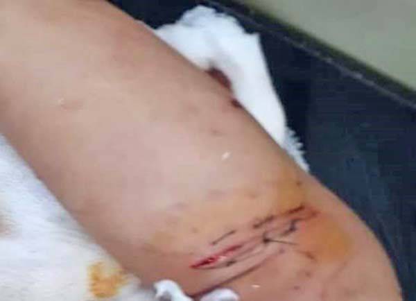 Al alza ataques de perros en Sabinas