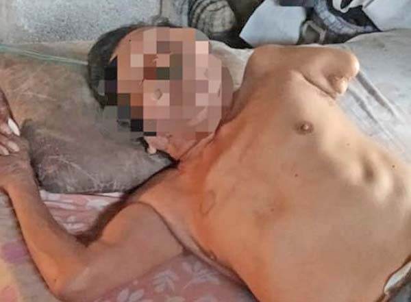 Claman ayuda para vecino de Las Moritas