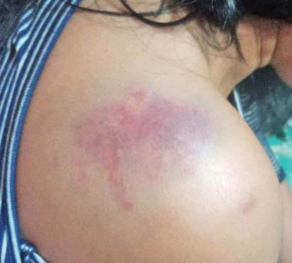 Cegado por celos; golpea a expareja