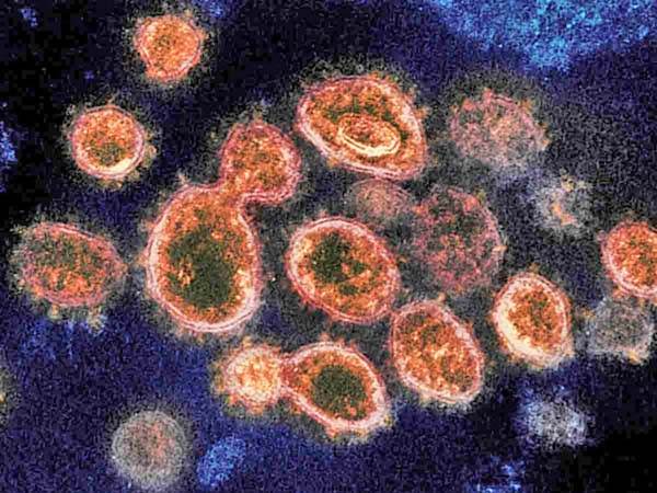Variante británica del covid sería más mortal