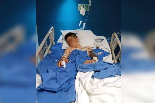 Amputan pierna a menor tras ser baleado por policías