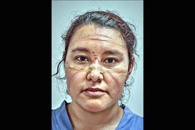 Premian foto de mexicano que refleja lucha contra Covid