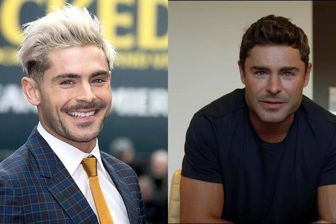 ¿Qué te hiciste en el rostro Zac Efron?