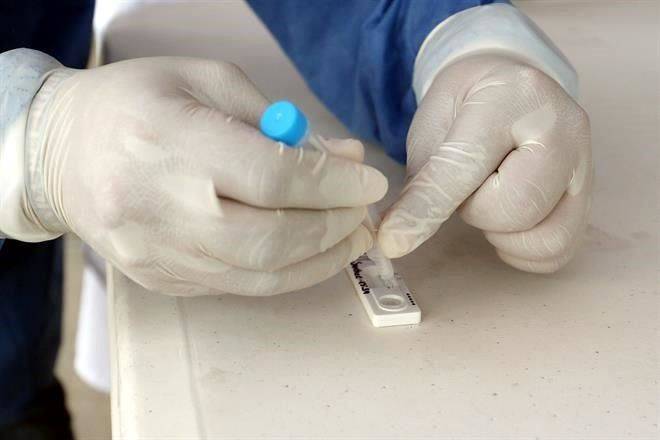 Detectan 30% de falsos negativos en pruebas rápidas