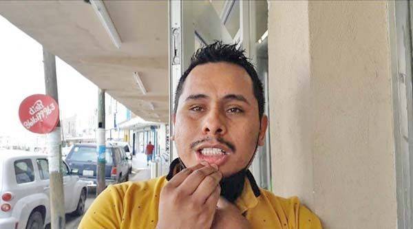 Recibe golpiza de la pareja de su ex