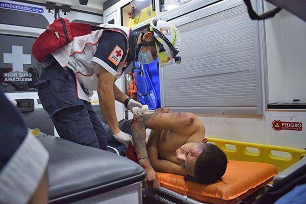 Lo encandilan y cae de moto
