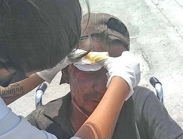 Se abre cabeza en caída