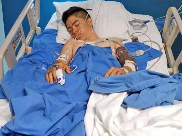 Policías en Guerrero disparan a grupo de jóvenes; uno pierde la pierna