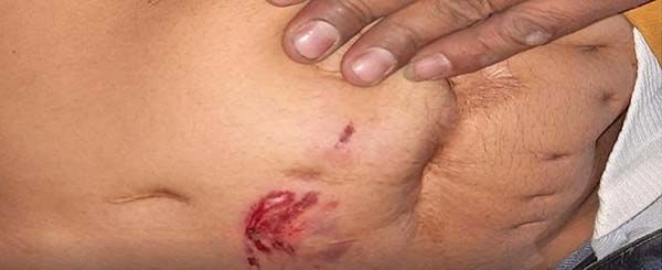 Perro de Ferromex ataca a hondureño
