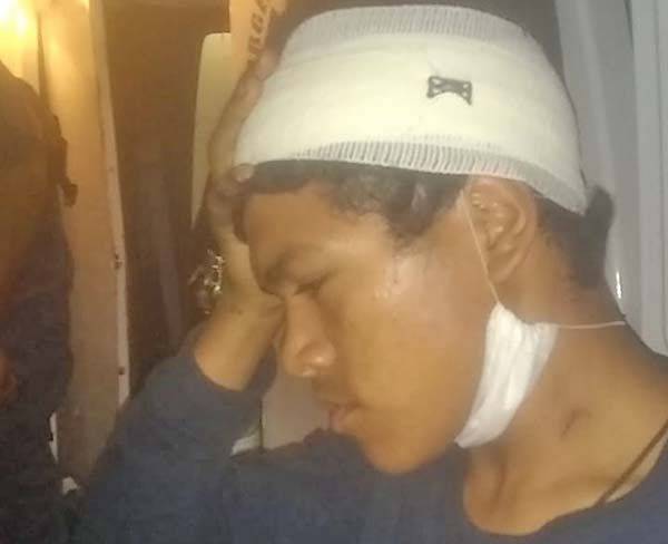Asaltantes le abren cabeza