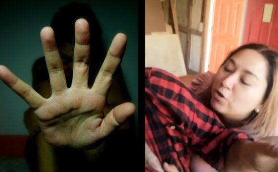 «Miren cómo me pega»: hombre denuncia violencia de ex pareja; caso causa indignación