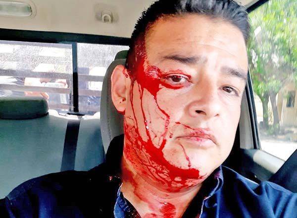 “Con un tubo le abrió la cabeza”