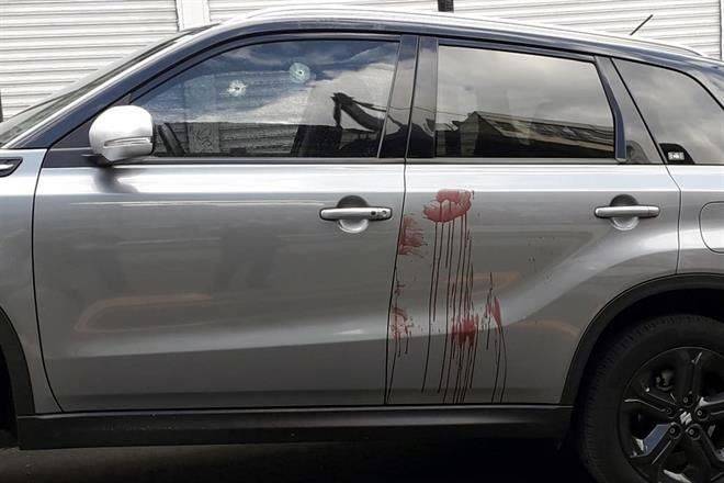 Balean a automovilista en Avenida Insurgentes
