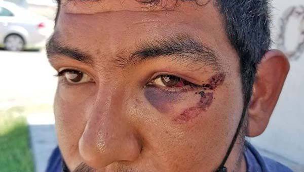 Termina en hospital; por querer evitarrobo de llantas