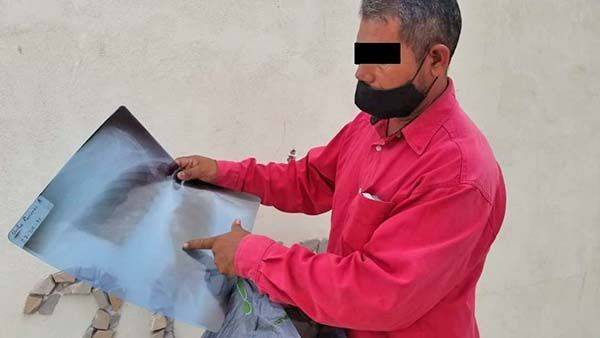 Vapulean y roban a vecino de Barroterán