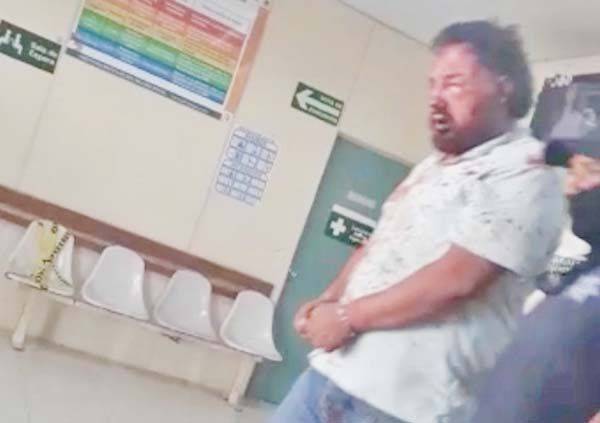 Le rompen mandíbula; acusan exceso policiaco