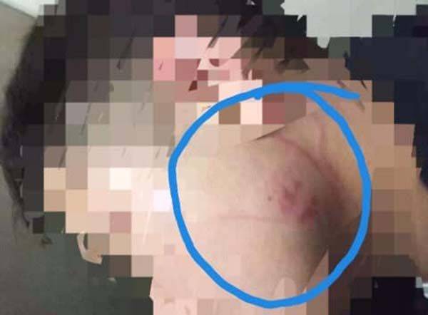 Sufre padre de familia agresión de su esposa