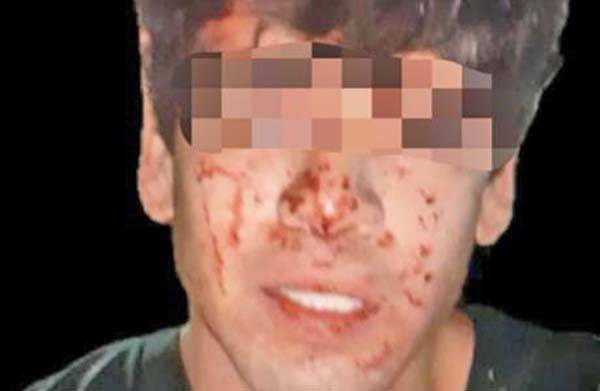 Enviarán ante el Juez a homicida de Esteban