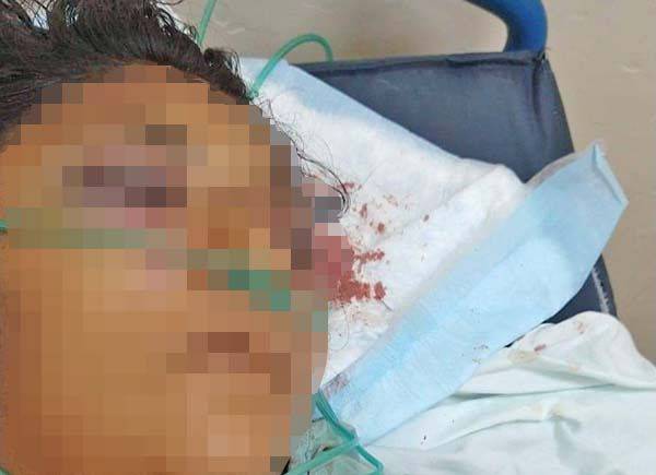 Coinciden en clínica Victoria y su agresor