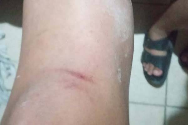 Denuncia mujer violencia marital