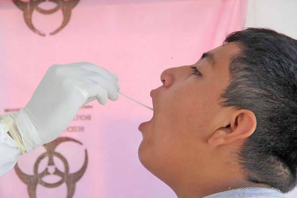 Informa criterios para solicitar prueba Covid