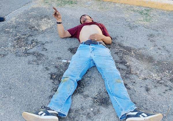 Ladrón de energía sigue hospitalizado