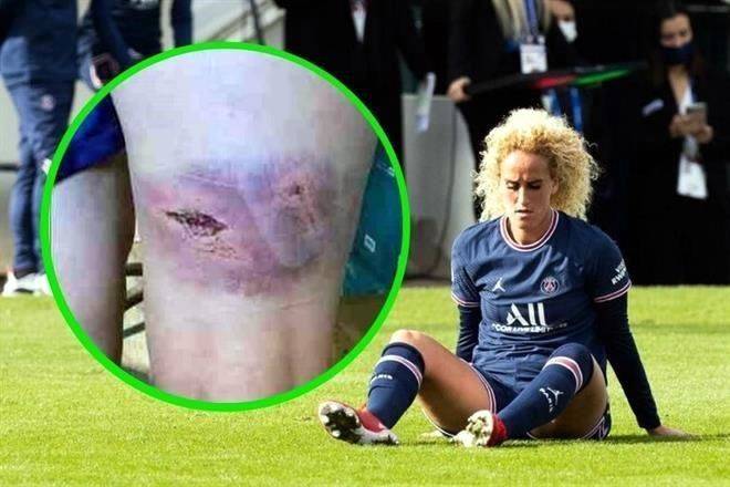 Publican foto de pierna de Hamraoui tras agresión