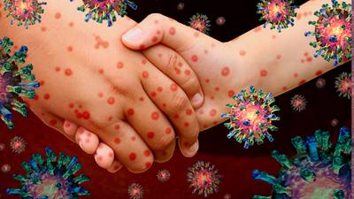 El sarampión vuelve a ser una amenaza mundial: 22 millones de bebés no se vacunaron durante la pandemia, advierten los CDC