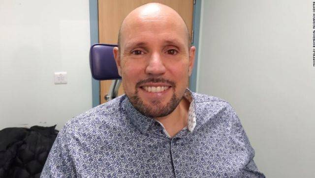 Un hombre británico recibe ojo impreso en 3D por primera vez en el mundo