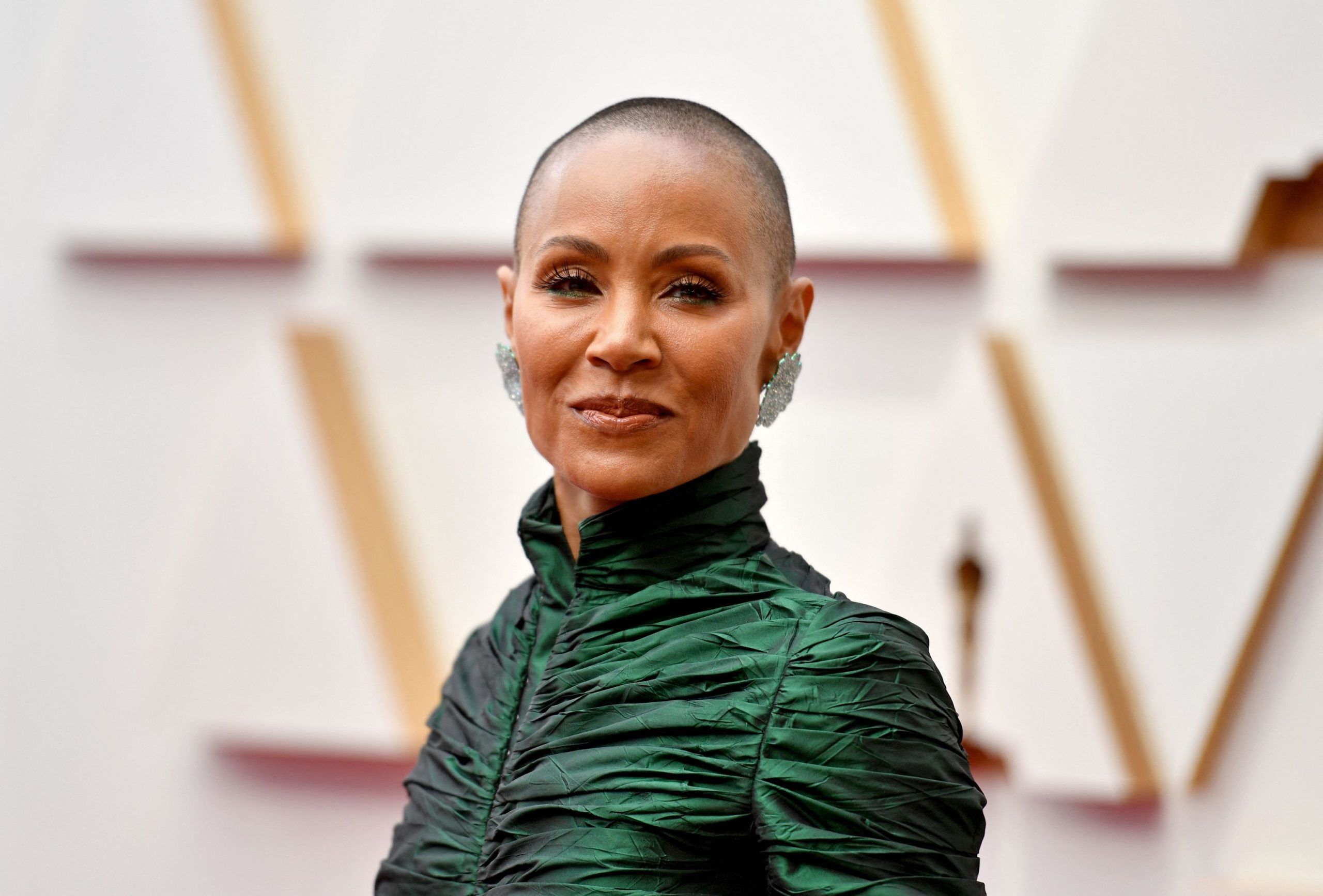 Alopecia: ¿qué es, qué la causa y cómo se trata?
