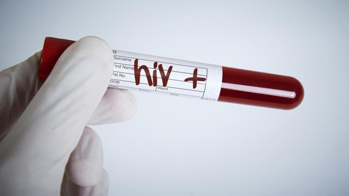 Trasplantes en pacientes con VIH, podrían terminar con tratamientos antirretrovirales