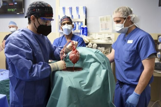 Murió primer paciente con trasplante de corazón de cerdo