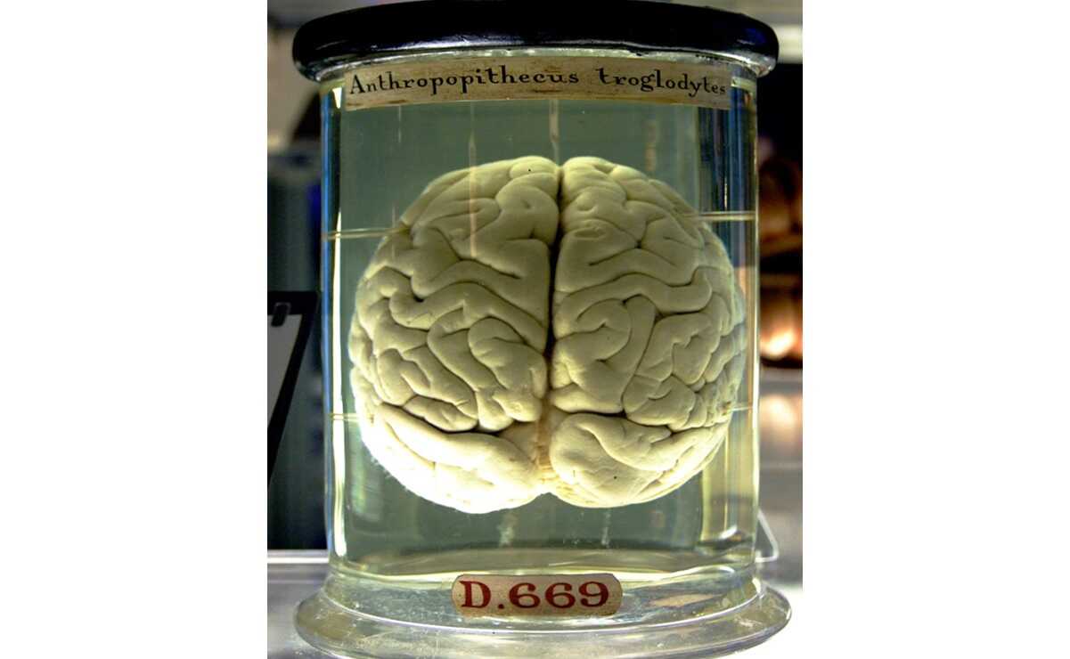 Enfermedades cerebrales ahora serán diagnosticadas con sonda y tecnología de luz