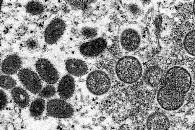 Ve OMS improbable una pandemia de viruela del mono