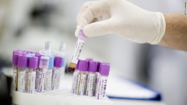 La detección del cáncer de próstata  mediante un análisis sanguíneo es mejor de lo que se pensaba en un  principio, sobre todo para los hombres de raza negra, según un estudio