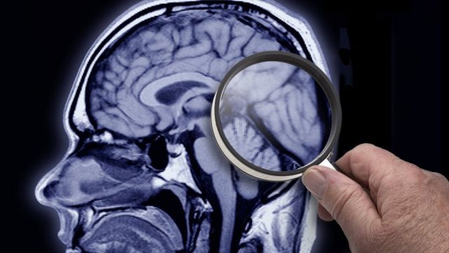Por qué los humanos hace 3.000 años tenían el cerebro más grande que el nuestro