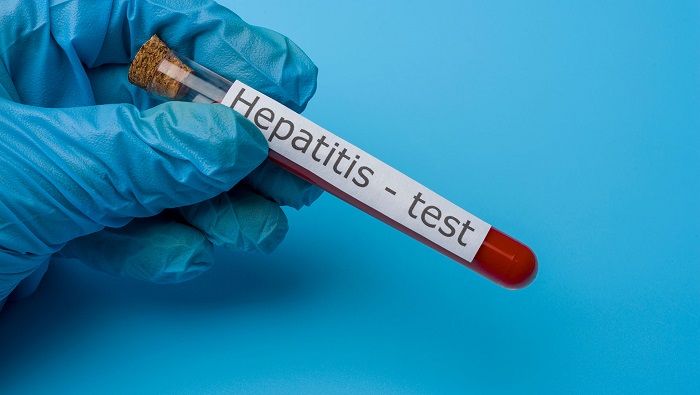 Siete cosas que hay que saber sobre la hepatitis
