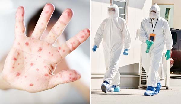 Implementan en Coahuila vigilancia epidemiológica