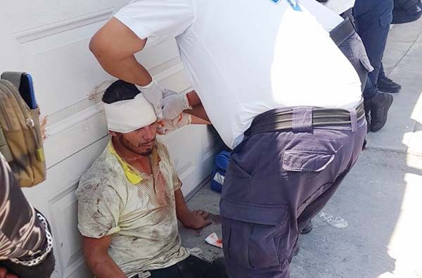 Asaltante se abre cabeza en huida