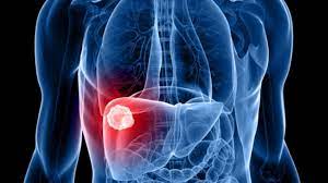 Detectan en Argentina el primer caso en América Latina de la hepatitis aguda de origen desconocido que ataca a los niños
