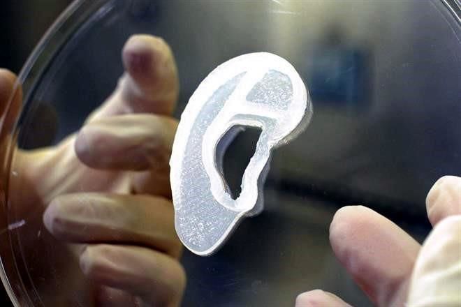 Implantan en EU, por primera vez, oreja impresa en 3D