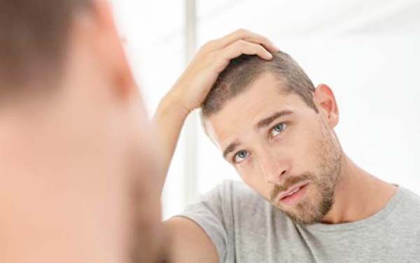 EU aprueba primera píldora para el tratamiento de la alopecia
