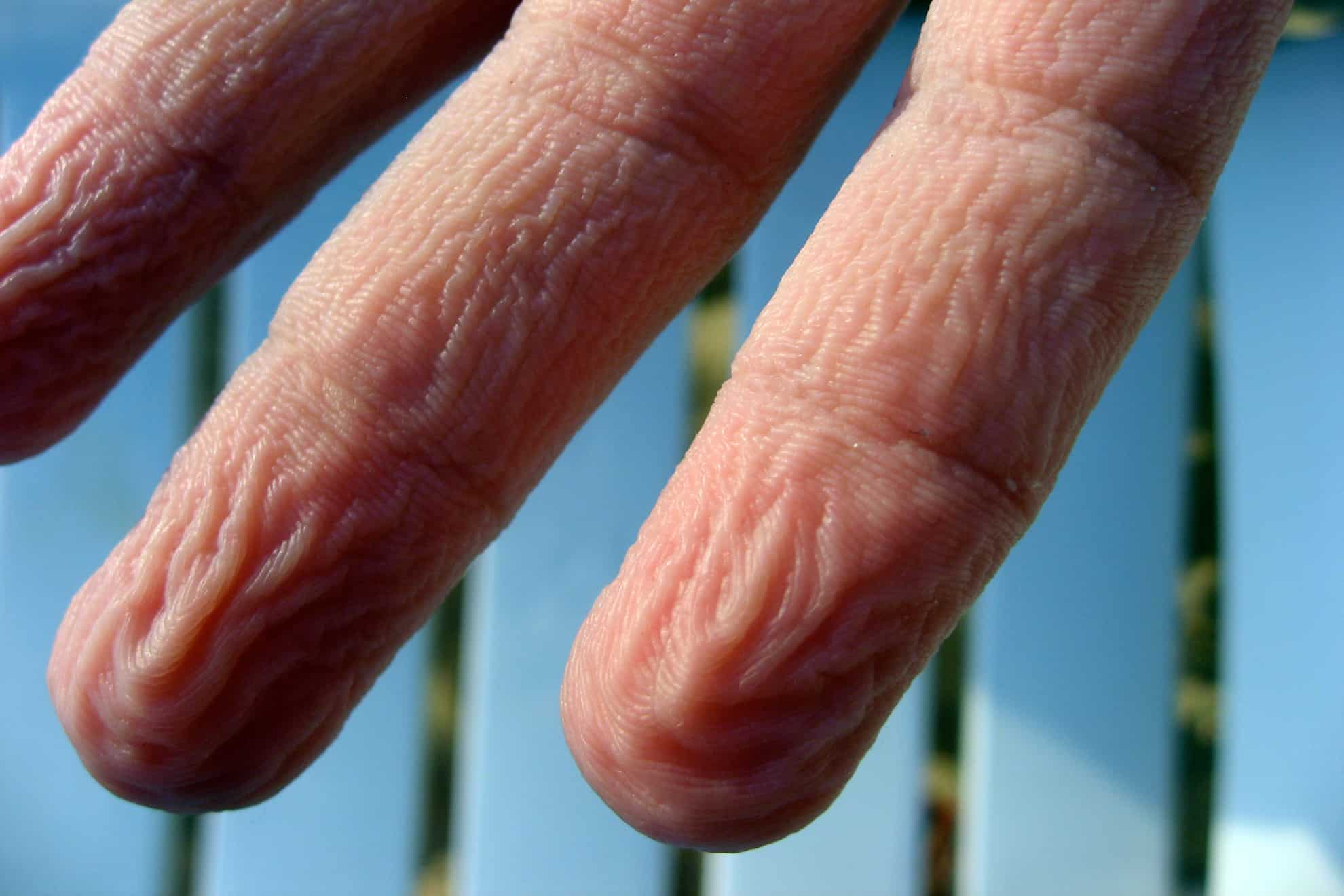 ¿Qué revelan de nuestra salud las arrugas de los dedos cuando se humedecen?